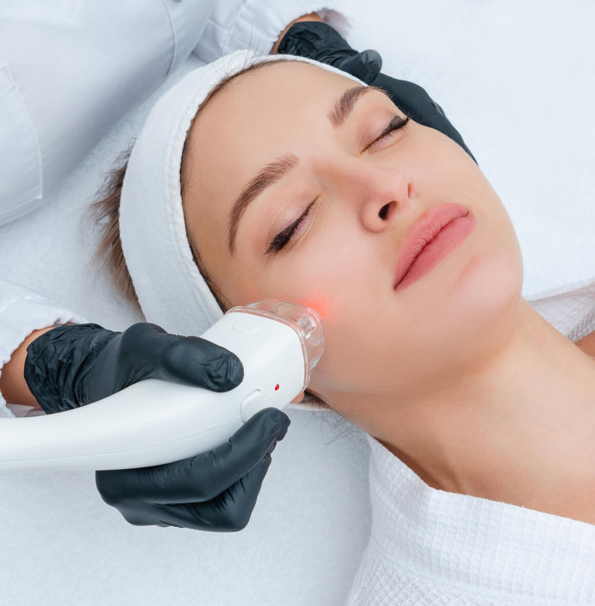 Professional, Proven, and Personalized Acne Treatment